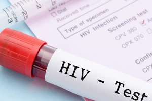 Ministério da Saúde de Angola veta reagente de testes de HIV