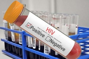 Dois resultados falsos positivos de HIV/sida em Angola foram &quot;reconfirmados negativos&quot; após novos testes