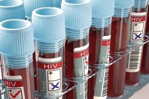 PGR averiguá falhas do reagente de teste de HIV