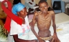 ONG preocupada com aumento de casos de malária, sida e tuberculose em angola