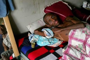 ONU aponta &quot;várias omissões&quot; e pede revisão da Lei sobre VIH/Sida em Angola
